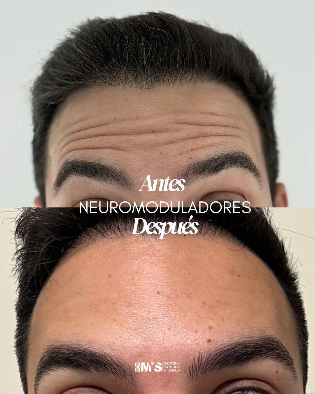 Resultado caso 2